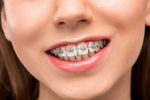 乳牙爲什麽容易晶壞？