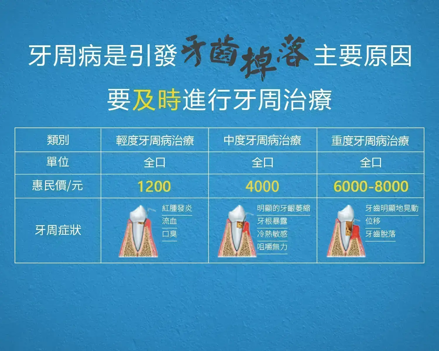 澳門牙周病治療收費
