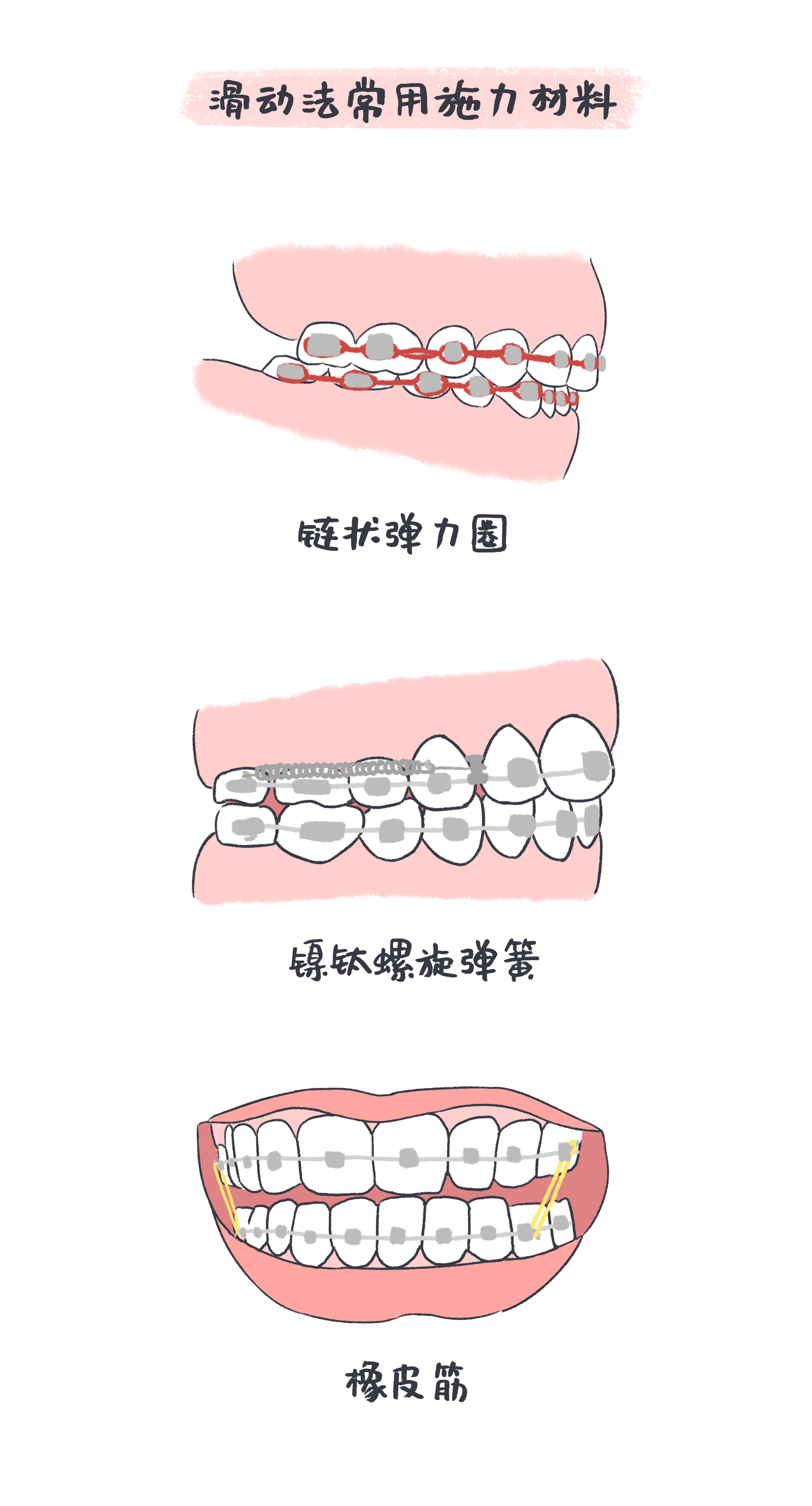 6滑動法.jpg