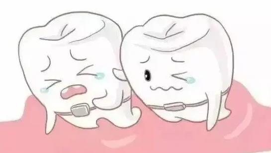 澳門箍牙，有牙周炎還可以矯正牙齒咩？