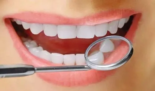 牙齒美白的三大方法：冷光美白、烤瓷牙和貼面，究竟該怎麼選擇？