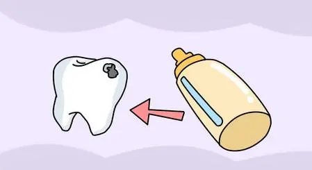 兒童牙醫推薦：奶瓶齲的危害這麼大，再不重視就晚了！