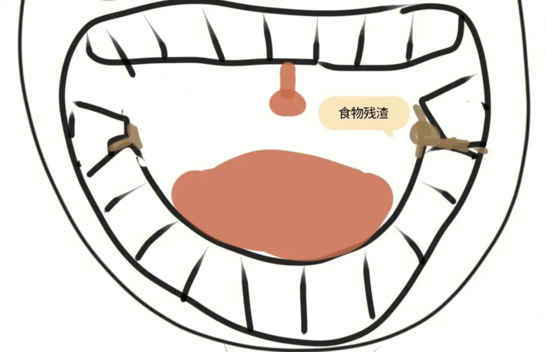 爲什麽智齒不適合一次都拔掉