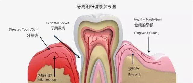 缺齒嘅人就係『殘疾人嗎？』！