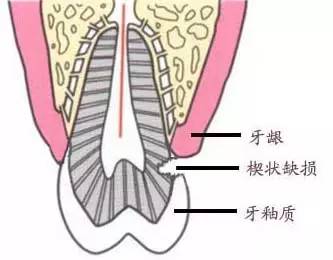 拔牙前隱瞞病史，後果好可怖啊