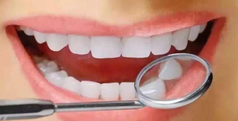 牙齒矯正分哪幾種類型