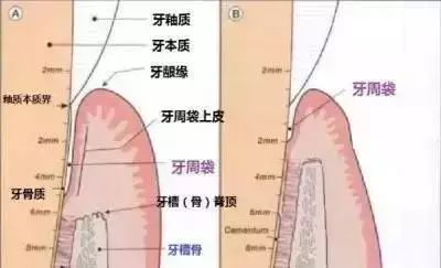 我只想洗個牙，爲什麼醫生叫我做牙周刮治？