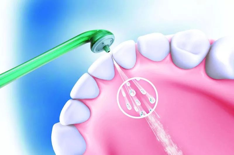 洗牙和牙周刮治到底有什麼區別？