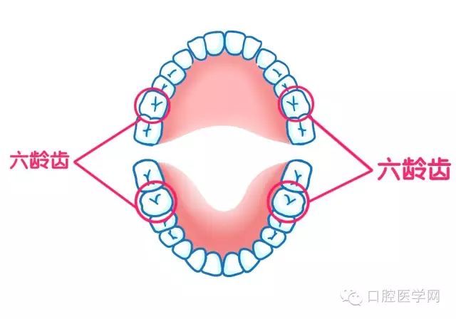 什麼是六齡齒，如何保護孩子六齡齒？