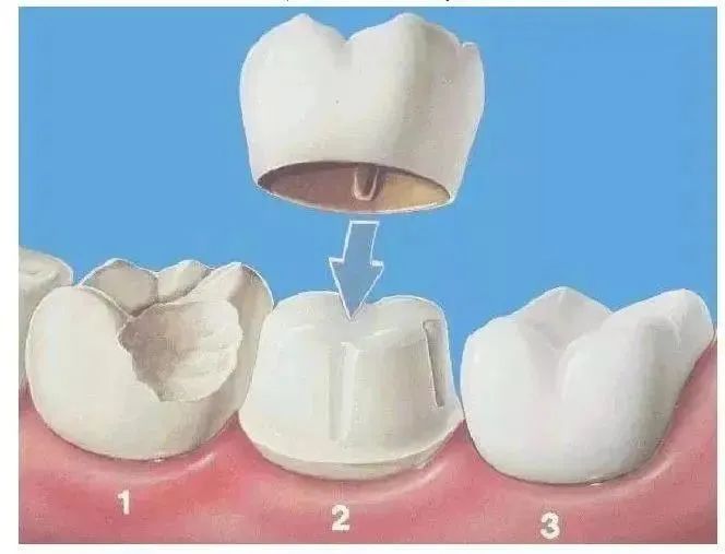 真的不打算管管你的殘牙嗎？