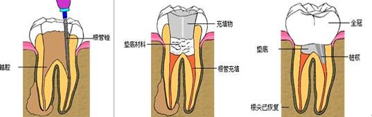 珠海杜牙根價錢