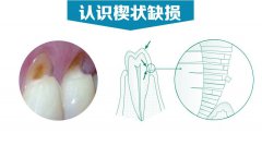 冷!冷!冷!寒潮來了!牙齒也畏寒怕冷怎麼辦?
