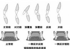 成年人還能否矯正？