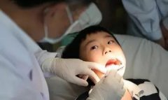 小孩子拔牙可以用麻藥嗎?