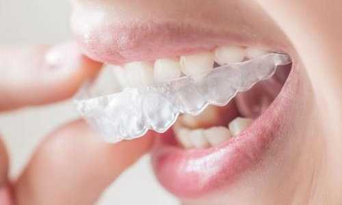 什麼是牙齦病？