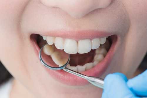 牙周科看什麼病？